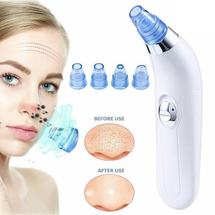 Blackhead Pore Cleaning Device