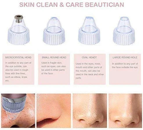 Blackhead Pore Cleaning Device