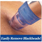 Blackhead Pore Cleaning Device