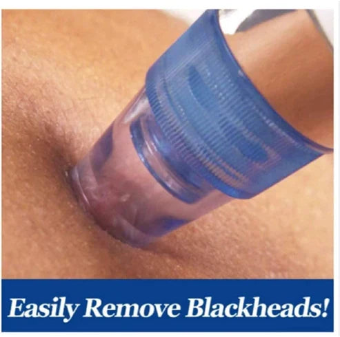 Blackhead Pore Cleaning Device